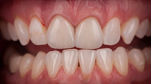 Teeth 9