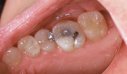 Microdentistry updated